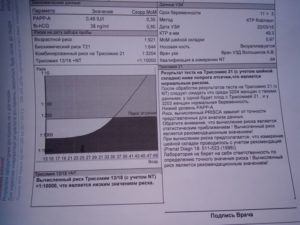 Комбинированный риск на Трисотомию21 1: 60