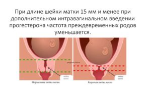 Магнезия и шейка матки при беременности