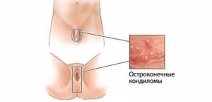 Маленькие половые органы