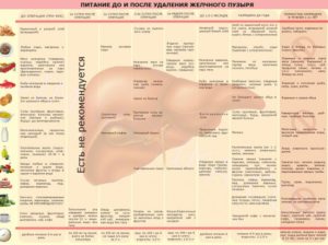 Лечение гастрита после удаления желчного пузыря