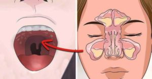 Боль в горле, заложенность носа