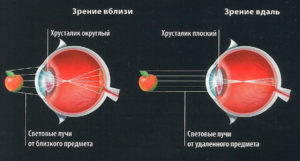 Истинное зрение при спазме