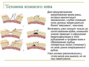 Консультация по качеству заживления шва