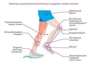 Болит выше колена при прыжке