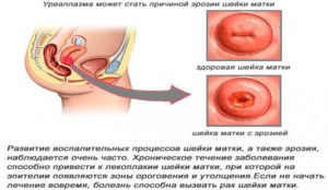Кровит эрозия при беременности после анализа