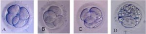 Кариотипирование, фрагментация эмбрионов