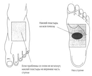 Боль с верхней части ступни