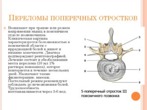 Перелом правого поперечного отростка