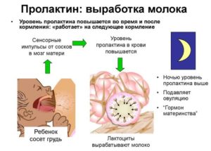 Болит грудь, высокий пролактин, гормоны