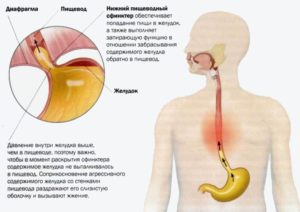 Боли и жжение в желудке