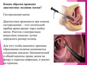 Когда можно жить половой жизнью после удаления полипа на матке?