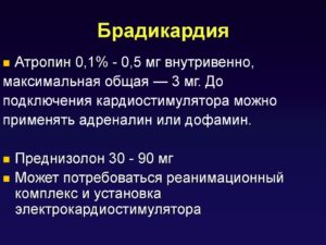 Брадикардия