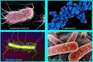 Кишечная палочка и золотистый стафилококк