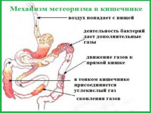 Боли слева при ходьбе. Зуд. Отрыжка воздухом, сильное газообразование