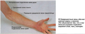 Болит правая рука с внутренней стороны по ходу вены