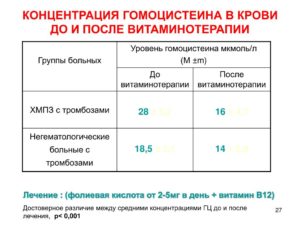 Когда можно сдавать анализ на гомоцистеин