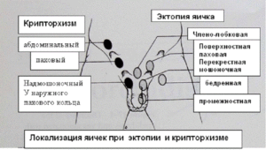 Перемещаются яички в паховую обл.