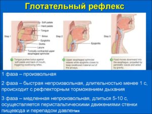 Инсульт, отказ от еды, нет глотательного рефлекса