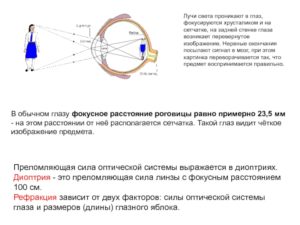 Искусственные хрусталики разной оптической силы