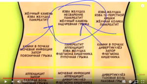Болит чуть выше пупка