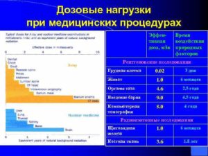 Большая ли лучевая нагрузка