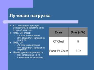 Большая ли лучевая нагрузка