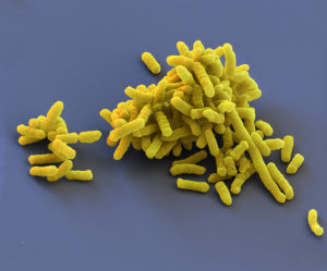 Klebsiella pneumoniae