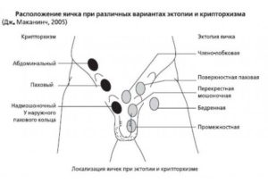 Перемещаются яички в паховую обл.