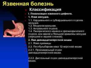 Каллёзная язва субкардиального отдела желудка