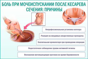 Боль в конце мочеиспускания