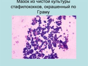 Кишечная палочка и золотистый стафилококк в мазке из глотки