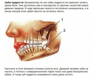 Болит зуб 6 слева внизу