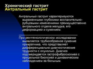 Хронический гиперацидный гастрит с нарушением функции ощелачивания в антральном отделе