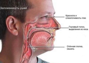 Боль в горле, заложенность носа, боль и заложенность ушей