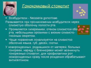 Кандидоз ротовой полости хламидия и кишечные инфекции