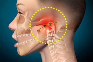Болит челюсть, не могу открывать рот и глотать