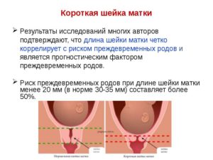 Магнезия и шейка матки при беременности