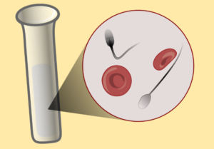 Кровь в моче и сперме