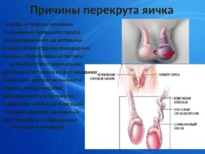 Боли после операции по перекруту яичка