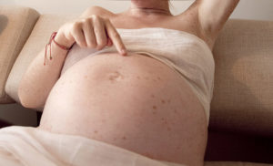 Краснуха беременность