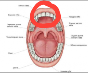 Красное нёбо как будто что то трескается и болит