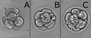 Кариотипирование, фрагментация эмбрионов