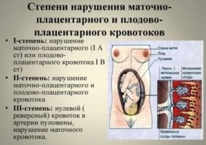 Маточно-плацентарная недостаточность 1а степени