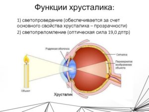 Искусственные хрусталики разной оптической силы