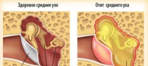 Из уха течет синяя или зеленая жидкость