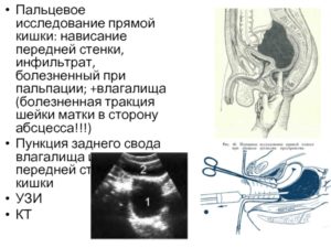 Боли в шейке матки и прямой кишке