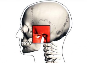Боль в месте соединения челюстей
