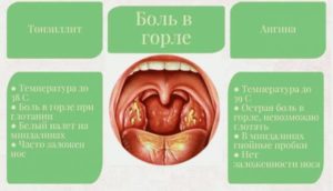 Боли в горле, температура