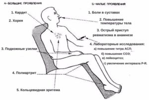 Болят суставы и ломит тело после температуры.