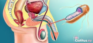 Болит пенис при мочеиспускании